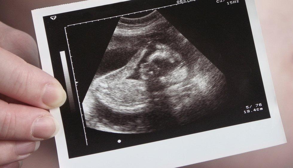 На 2 и 3 месяц беременности на УЗИ. Снимок УЗИ беременности 4 месяца. УЗИ 2 месяца беременности. Малыш на 16 неделе беременности УЗИ. 16 неделя 2023
