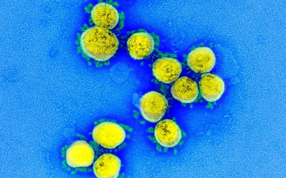 Belgian woman infected by two virus variants simultaneously