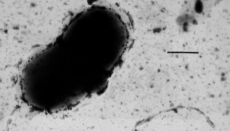 Can this bacteria cause Parkinson’s disease?